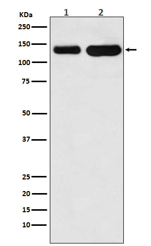 1 - Anti-K-Cadherin-6 CDH6-Monoclonal Antibody ABO14721