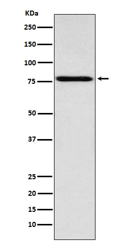 1 - Anti-Coilin Rabbit Monoclonal Antibody ABO14729