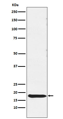1 - Anti-TSH beta Rabbit Monoclonal Antibody ABO14731