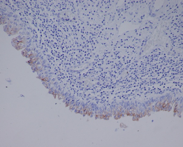 2 - Anti-Uroplakin3a UPK3A Monoclonal Antibody ABO14744
