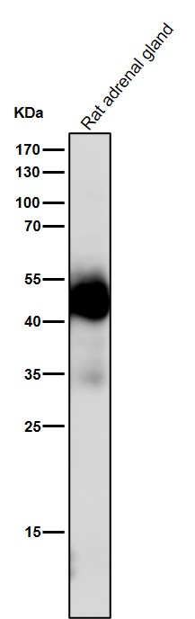 1 - Anti-Uroplakin3a UPK3A Monoclonal Antibody ABO14744