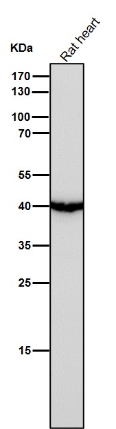 1 - Anti-Uroplakin3a UPK3A Monoclonal Antibody ABO14744