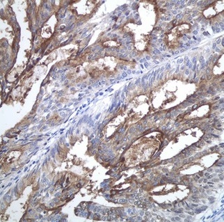 2 - Anti-CA125 / MUC16 Monoclonal Antibody ABO14746