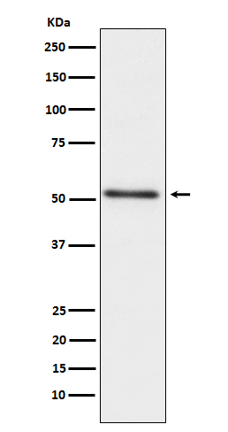 1 - Anti-Prostatic Acid Phosphatase ACPP Monoclonal Antibody ABO14748