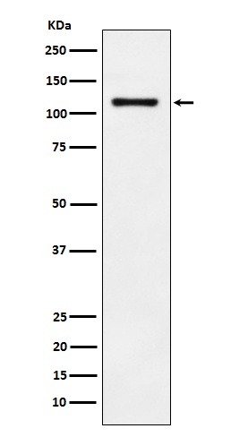 1 - Anti-LI-Cadherin-17 CDH17-Rabbit Monoclonal Antibody ABO14749