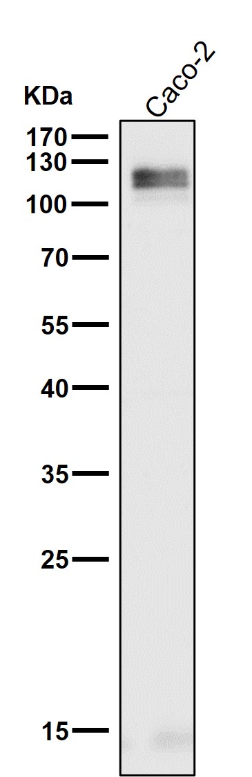 1 - Anti-LI-Cadherin-17 CDH17-Rabbit Monoclonal Antibody ABO14749