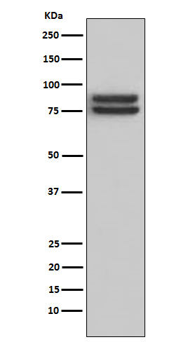 1 - Anti-FOXP1 Monoclonal Antibody ABO14750