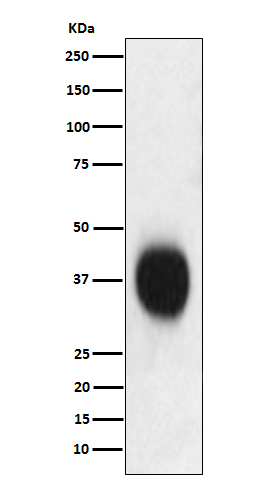 1 - Anti-CD53 Monoclonal Antibody ABO14753