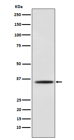 1 - Anti-Myogenin Monoclonal Antibody ABO14754