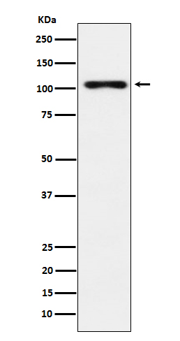 1 - Anti-TPO Monoclonal Antibody ABO14755