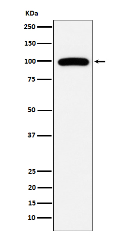 1 - Anti-CD10 MME Monoclonal Antibody ABO14758