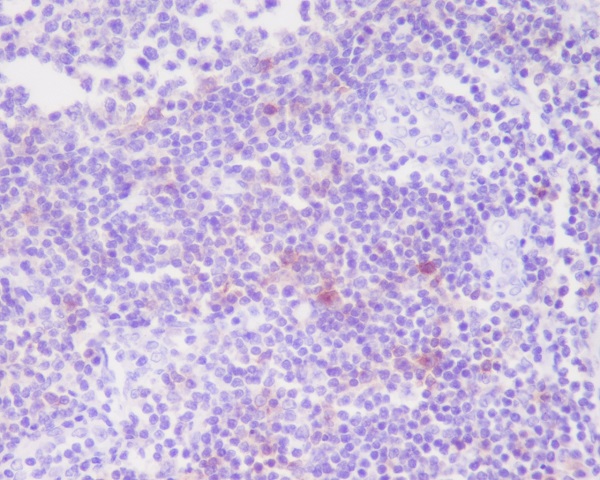 2 - Anti-CD25 IL2RA Monoclonal Antibody ABO14759
