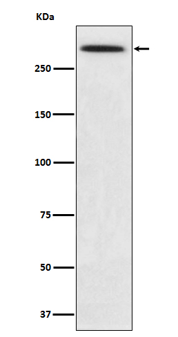1 - Anti-SPTA1 Rabbit Monoclonal Antibody ABO14762