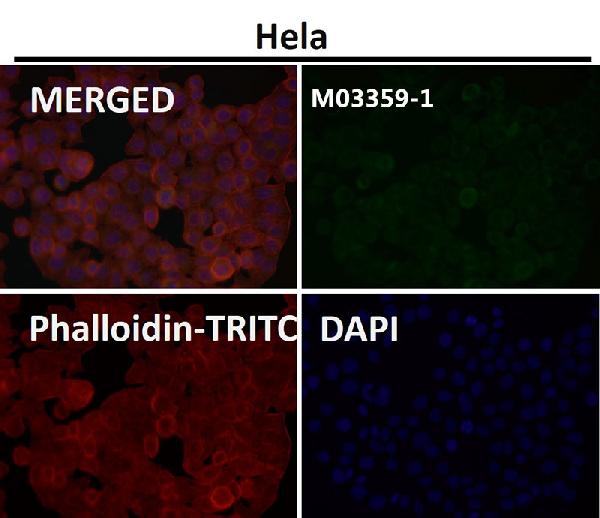 1 - Anti-PODXL Monoclonal Antibody ABO14763