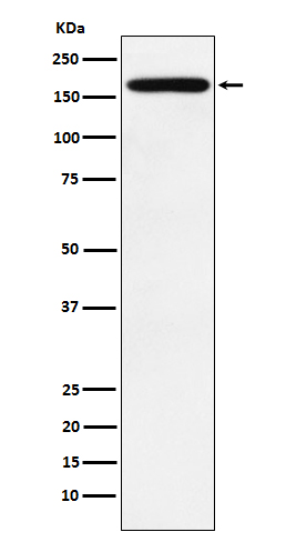 1 - Anti-PODXL Monoclonal Antibody ABO14763