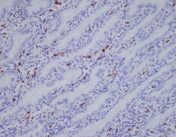 2 - Anti-IBA1 AIF1 Monoclonal Antibody ABO14764