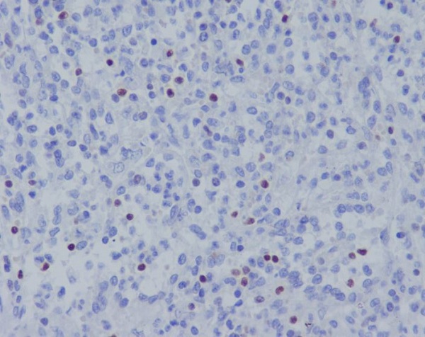 2 - Anti-TBX21 Rabbit Monoclonal Antibody ABO14766