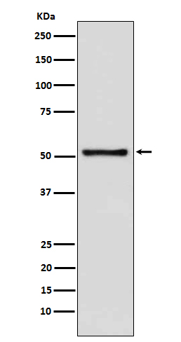 1 - Anti-TDT DNTT Monoclonal Antibody ABO14767
