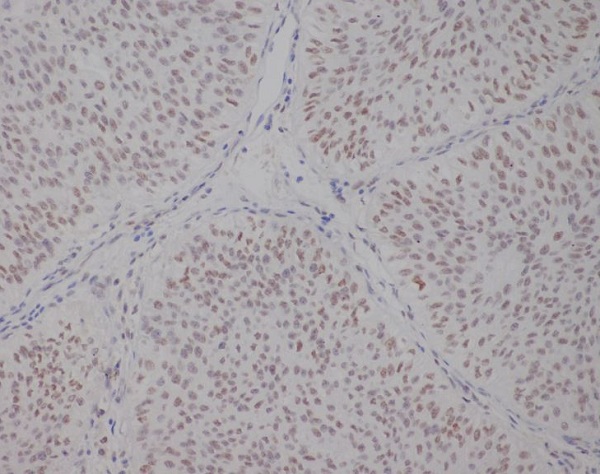 2 - Anti-TFE3 Monoclonal Antibody ABO14769