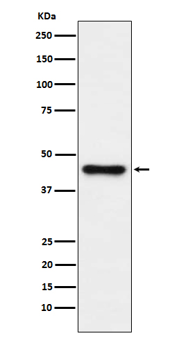 1 - Anti-ABHD5 Monoclonal Antibody ABO14771