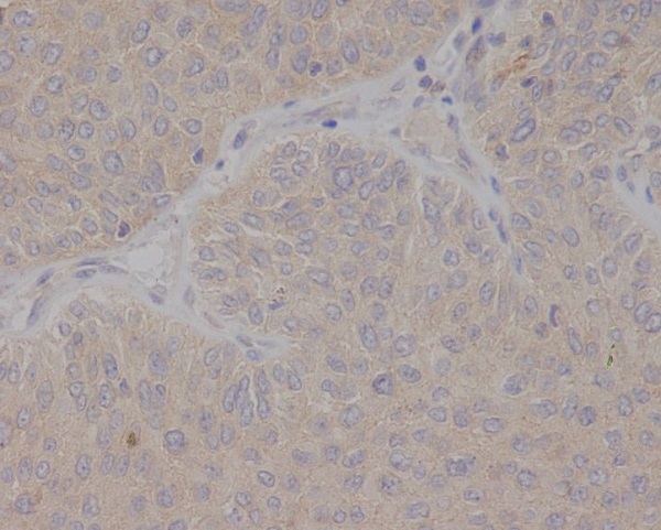 2 - Anti-GCET2 Monoclonal Antibody ABO14772