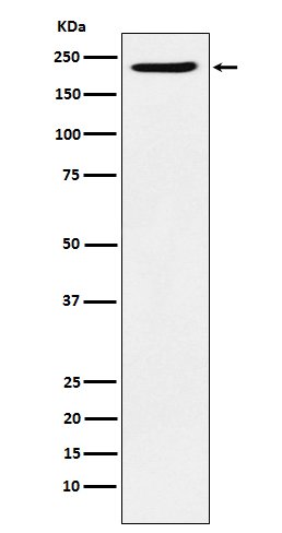 1 - Anti-PBRM1 Rabbit Monoclonal Antibody ABO14773