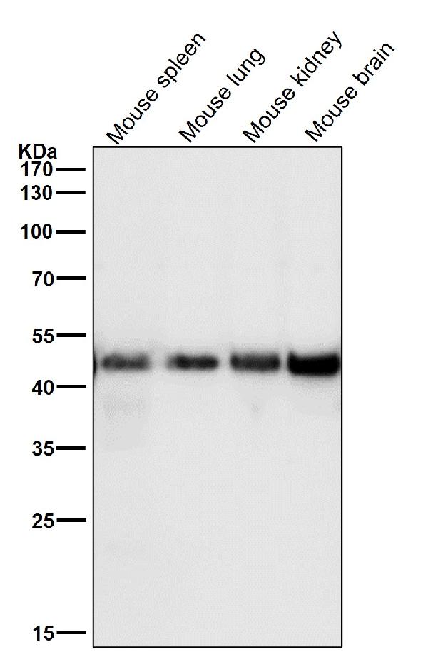 1 - Anti-FDFT1 Monoclonal Antibody ABO14774