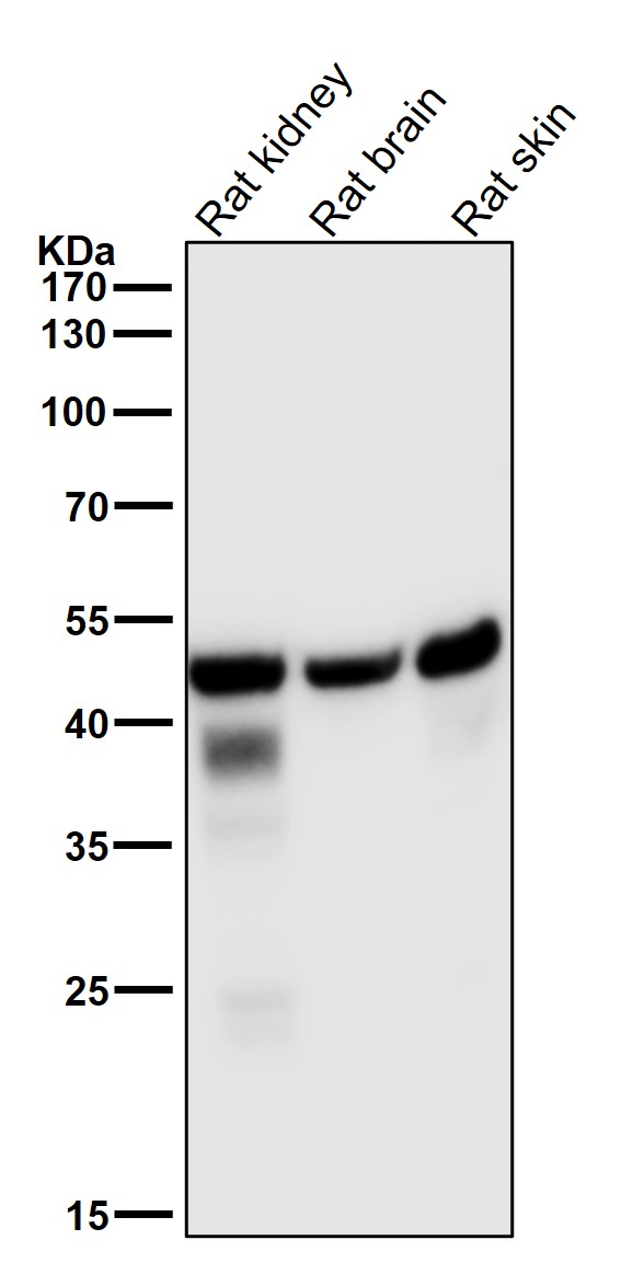 1 - Anti-FDFT1 Monoclonal Antibody ABO14774