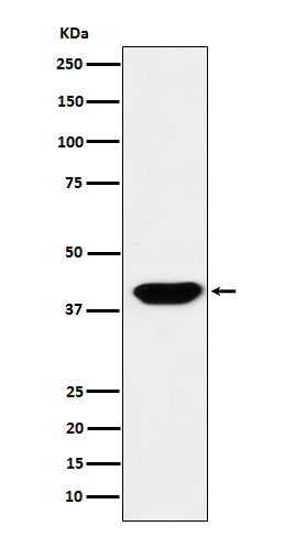 1 - Anti-Islet1 Monoclonal Antibody ABO14777