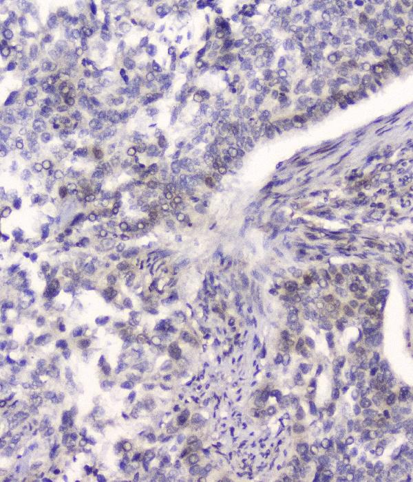 2 - Anti-HSPA2 Antibody Picoband™ (monoclonal, 4A4) ABO14778