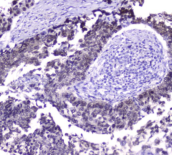 2 - Anti-Hsp70 HSPA1A Antibody Picoband™ (monoclonal, 3H5) ABO14779