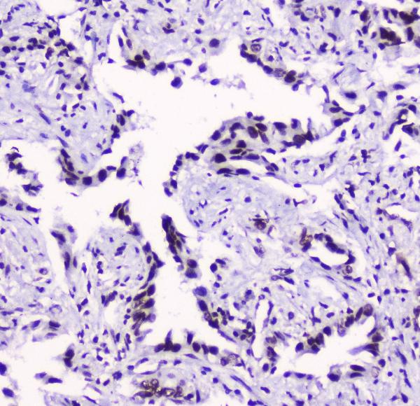 2 - Anti-SMC3 Antibody Picoband™ (monoclonal, 4C12) ABO14780