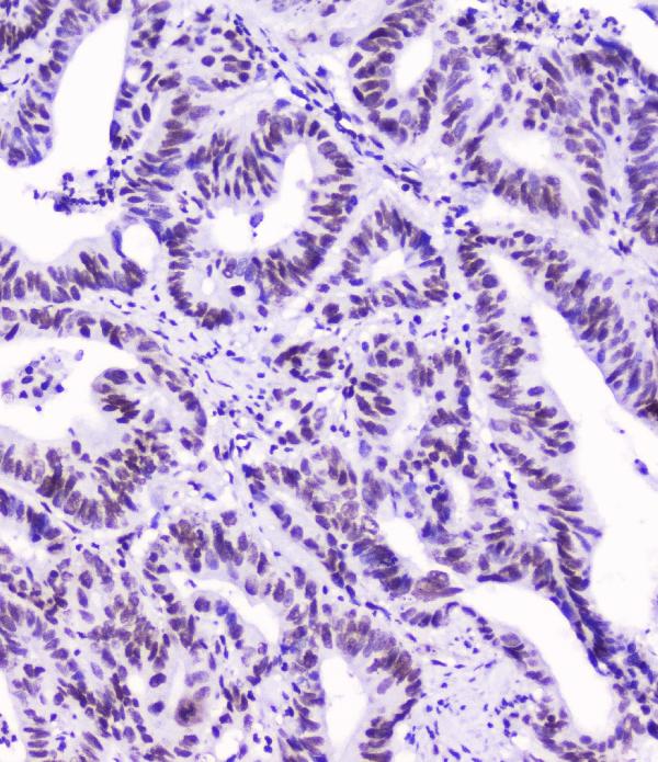 2 - Anti-SMC3 Antibody Picoband™ (monoclonal, 4C12) ABO14780