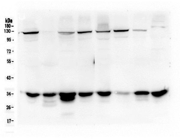 1 - Anti-AMPK beta 2 PRKAB2 Antibody Picoband™ (monoclonal, 6G1) ABO14781