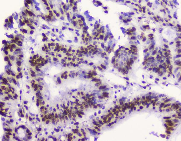 2 - Anti-RbAp48 RBBP4 Antibody Picoband™ (monoclonal, 9F3) ABO14782