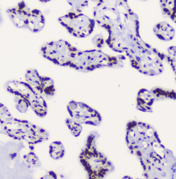 2 - Anti-RbAp48 RBBP4 Antibody Picoband™ (monoclonal, 9F3) ABO14782