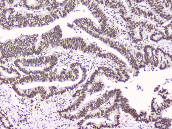 2 - Anti-RbAp48 RBBP4 Antibody Picoband™ (monoclonal, 9F3) ABO14782