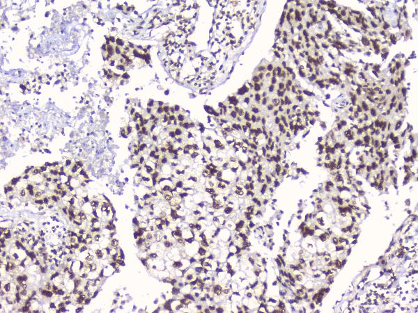 2 - Anti-RbAp48 RBBP4 Antibody Picoband™ (monoclonal, 9F3) ABO14782