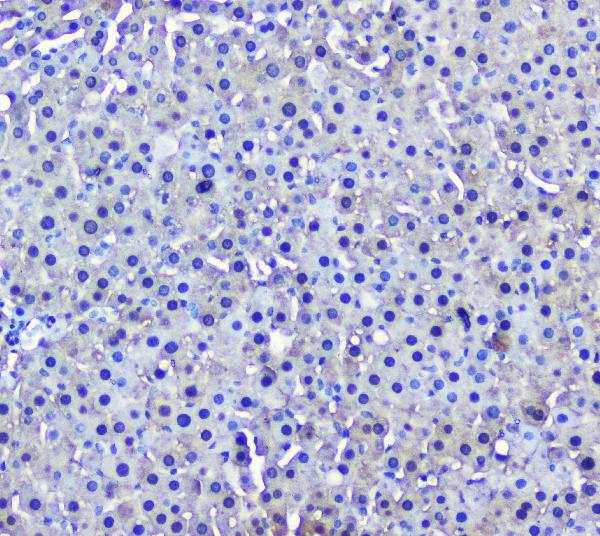 2 - Anti-GSTM1 Antibody Picoband™ (monoclonal, 11F2) ABO14784