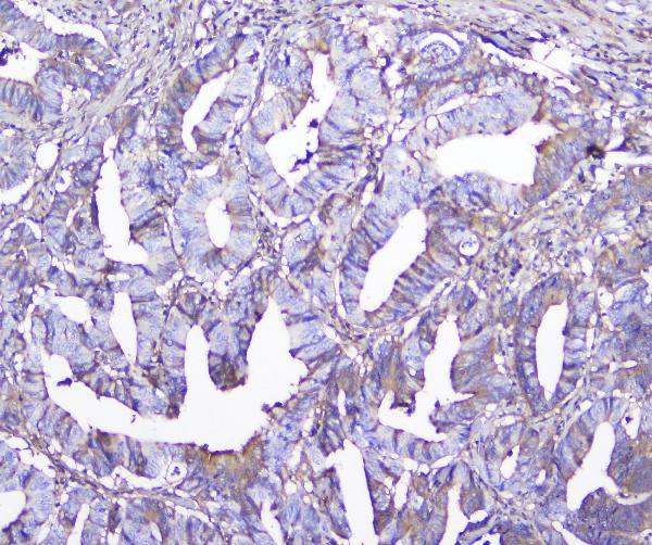 2 - Anti-GSTM1 Antibody Picoband™ (monoclonal, 11F2) ABO14784