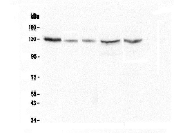 1 - Anti-CASR Antibody Picoband™ (monoclonal, 11E9) ABO14786