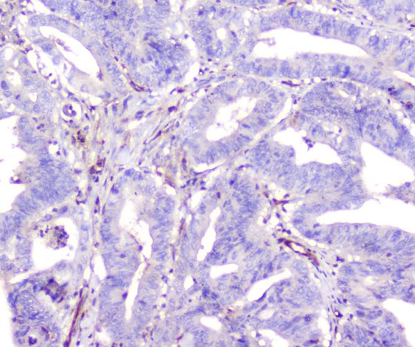 2 - Anti-ADA Antibody Picoband™ (monoclonal, 6D4) ABO14798