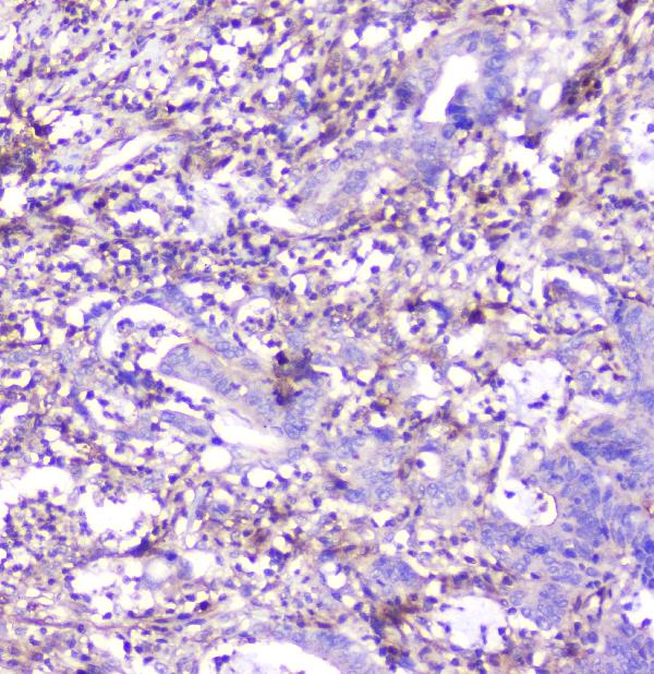 2 - Anti-ADA Antibody Picoband™ (monoclonal, 6D4) ABO14798