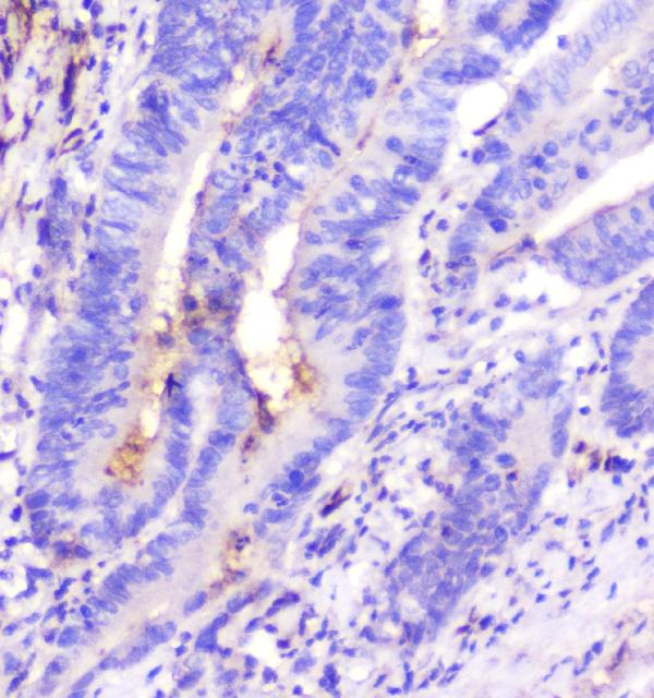 2 - Anti-ADA Antibody Picoband™ (monoclonal, 6D4) ABO14798