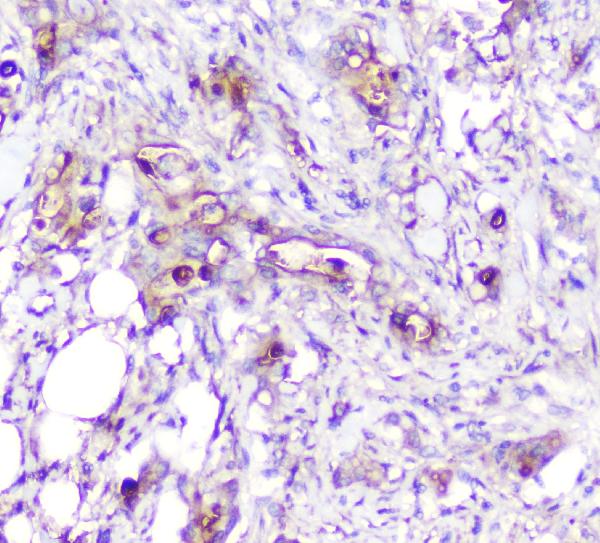 2 - Anti-ADA Antibody Picoband™ (monoclonal, 6D4) ABO14798