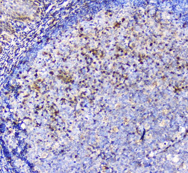 2 - Anti-ADA Antibody Picoband™ (monoclonal, 6D4) ABO14798