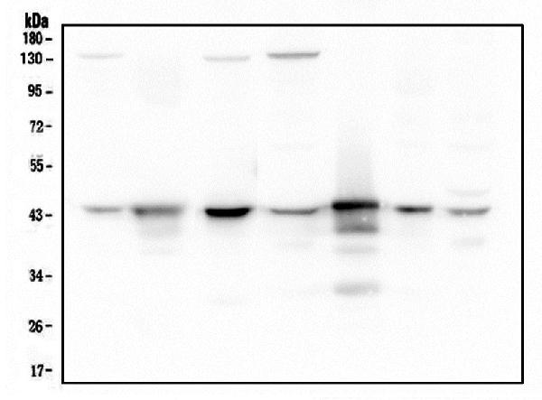 1 - Anti-ADA Antibody Picoband™ (monoclonal, 6D4) ABO14798