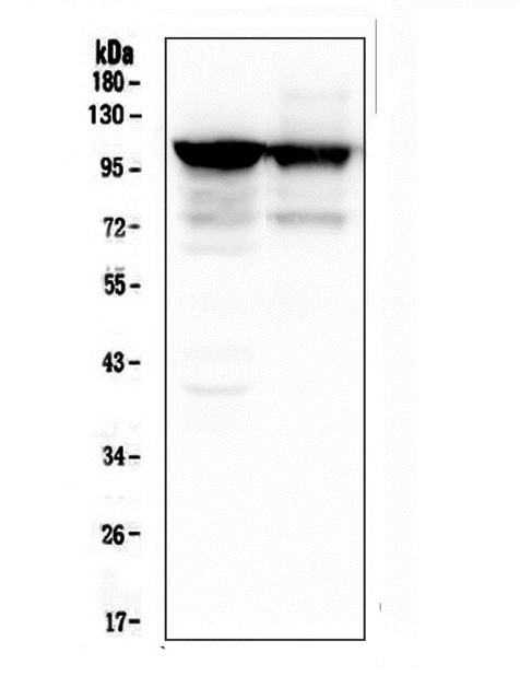 1 - Anti-ACTN3 Antibody Picoband™ (monoclonal, 9B5) ABO14800