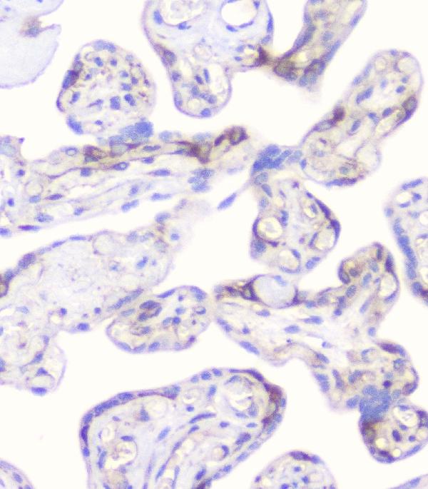 2 - Anti-CD2AP Antibody Picoband™ (monoclonal, 5F8) ABO14802