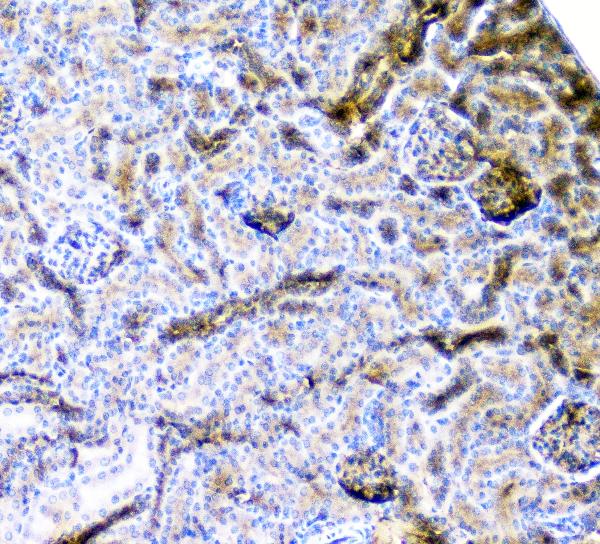 2 - Anti-CD2AP Antibody Picoband™ (monoclonal, 5F8) ABO14802